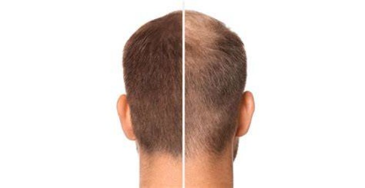Does omega3 help hair?