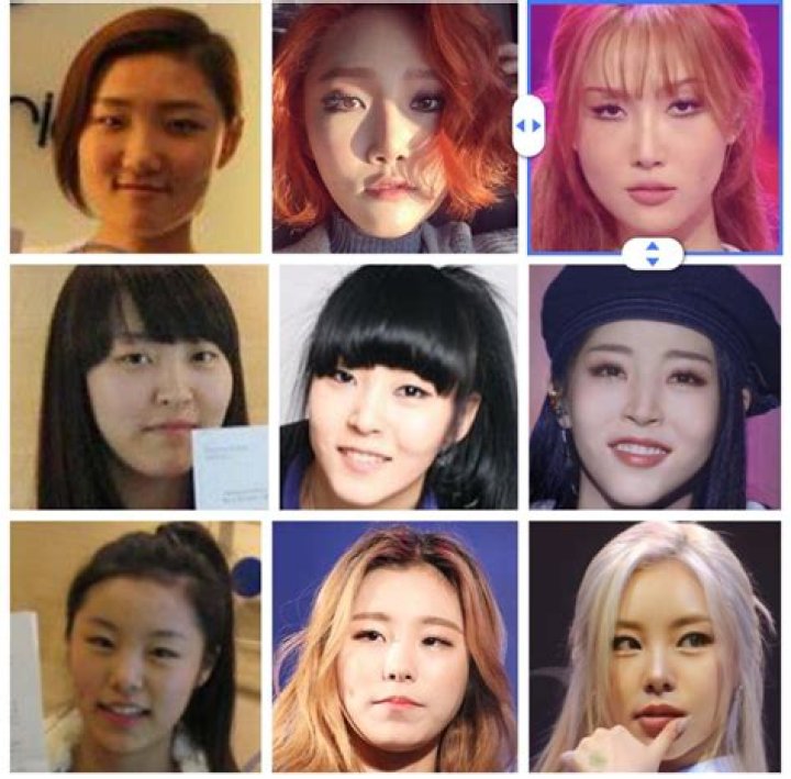 Which KPOP Idol did plastic surgery?